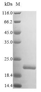 Zinc/RING finger protein 3 (ZNRF3), partial, human, recombinant