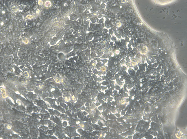 HROC40 Cells