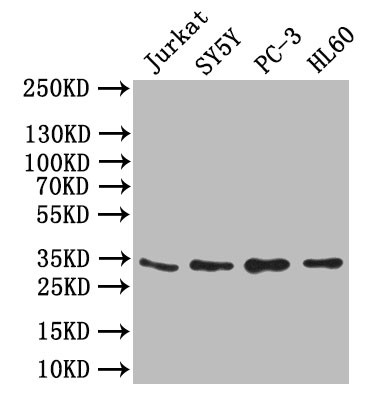 Anti-UCP1