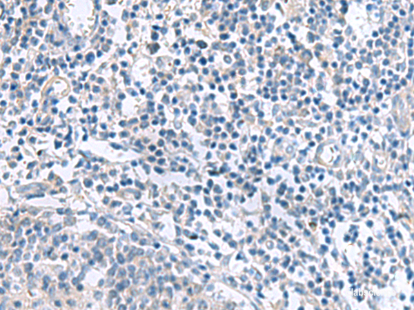 Anti-MYL1