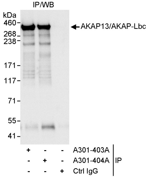Anti-AKAP13/AKAP-Lbc