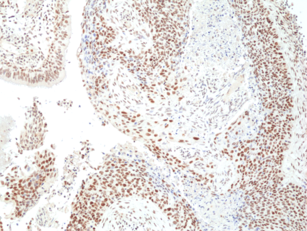Anti-HDAC3 (human), Rabbit Monoclonal (RM439)