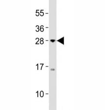 Anti-Olig3 Antibody