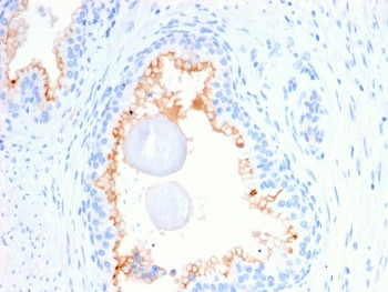 Anti-CD10 / Neprilysin, clone MME/2580