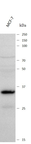 Anti-C1orf35