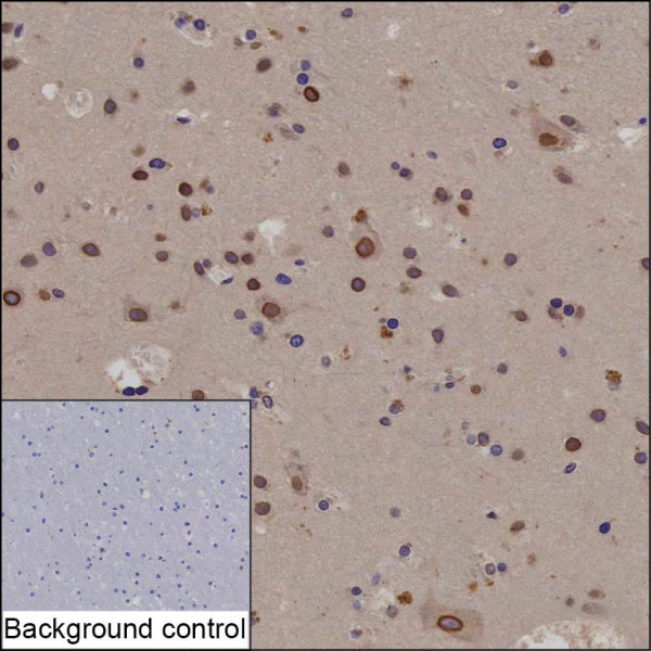 Anti-C1orf21
