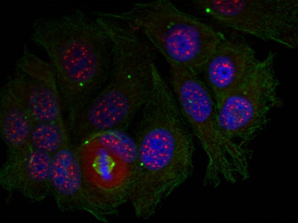 Anti-phospho-MEF2A (Thr319)