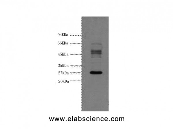 Anti-Galectin 3, clone 1A2