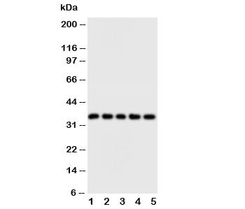 Anti-FosB
