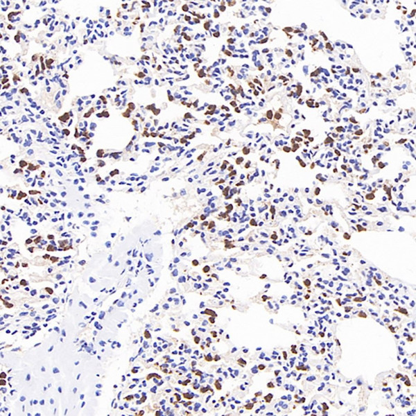 Anti-MMP9, clone 5C11C10