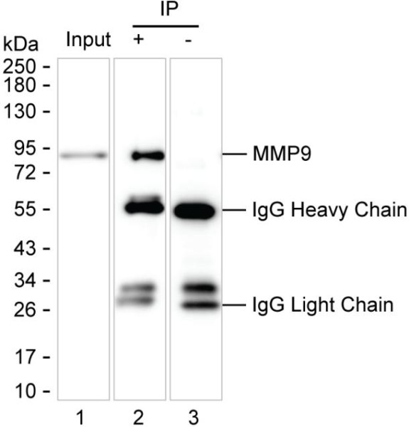 Anti-MMP9