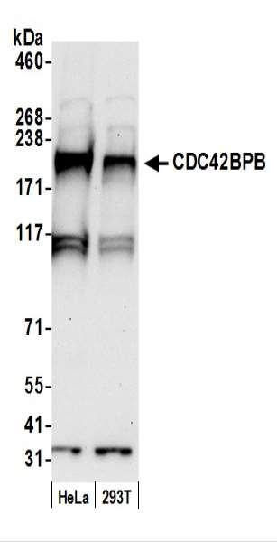 Anti-CDC42BPB/MRCK beta