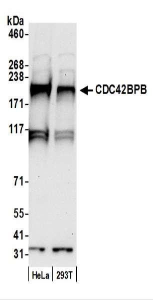 Anti-CDC42BPB/MRCK beta