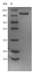 Neuroendocrine convertase 1 (Pcsk1), rat, recombinant