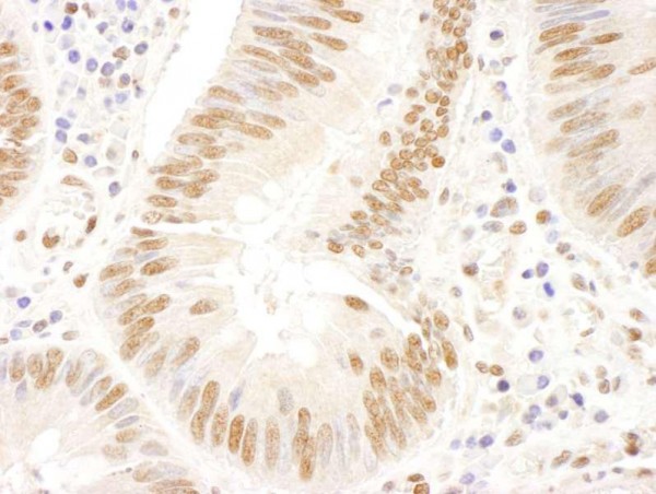 Anti-FANCD2 (IHC)