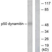Anti-DCTN2