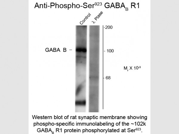 Anti-phospho-GABA(B) Receptor 1 (Ser923)