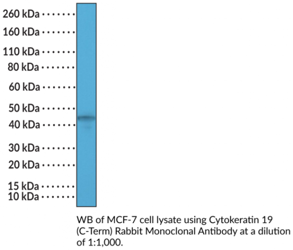 Anti-Cytokeratin 19 (C-Term) Rabbit Monoclonal Antibody (Clone RM364)