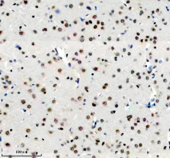 Anti-DDX17 / DEAD-box helicase 17, clone 23D15