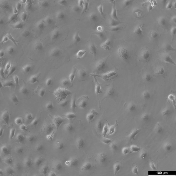 MDA-MB-157 Cells