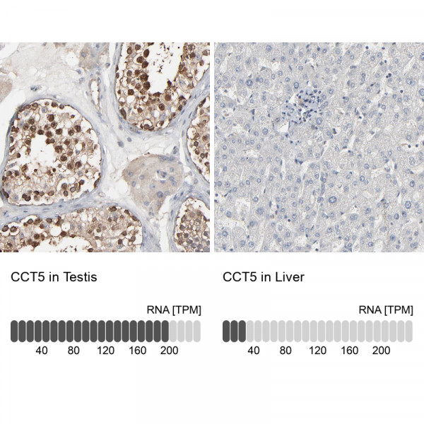 Anti-CCT5
