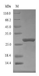 Suppressor of cytokine signaling 1 (Socs1), mouse, recombinant