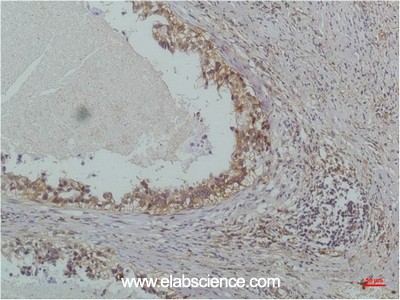 Anti-NFKBIB, clone 3E4