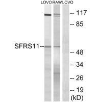 Anti-SRSF11