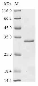 Alpha-crystallin A chain (Cryaa), mouse, recombinant