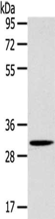 Anti-SLC25A20