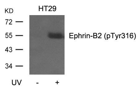 Anti-Phospho-EFNB2 (Tyr316)
