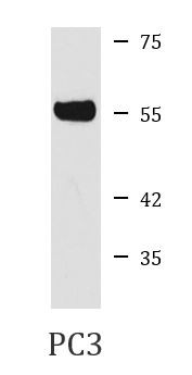 Anti-PRP19