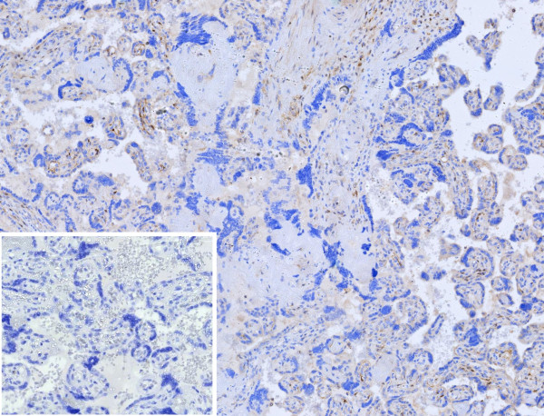 Anti-Choline Acetyltransferase (CHAT) (Marker of Cholinergic Cells), recombinant antibody, clone r38