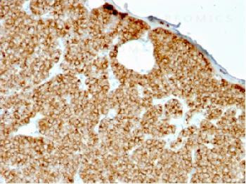 Anti-Parathyroid Hormone (PTH) (N-Terminal) Recombinant Mouse Monoclonal Antibody (clone:rPTH/911)