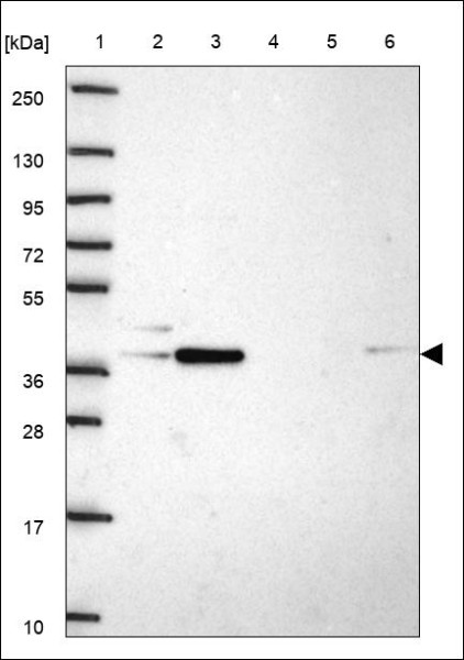 Anti-TMEM41B