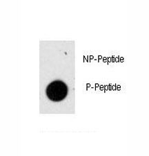 Anti-phospho-GFAP (Ser8)