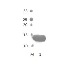MAGI1_6 PDZ Domain