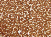 Anti-ALDH7A1 Monoclonal Antibody