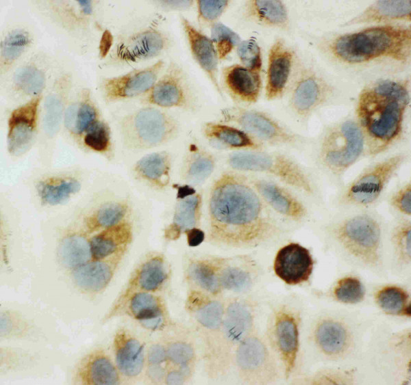 Anti-HYAL1