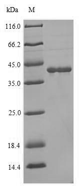 Lutropin-choriogonadotropic hormone receptor (LHCGR), partial, human, recombinant