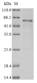 Pyruvate dehydrogenase protein X component, mitochondrial (PDHX), human, recombinant