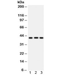Anti-HLA-A
