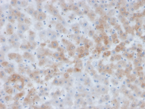 Anti-Alpha-1-Antichymotrypsin (SERPINA3) (Histiocytoma Marker), clone SERPINA3/4184