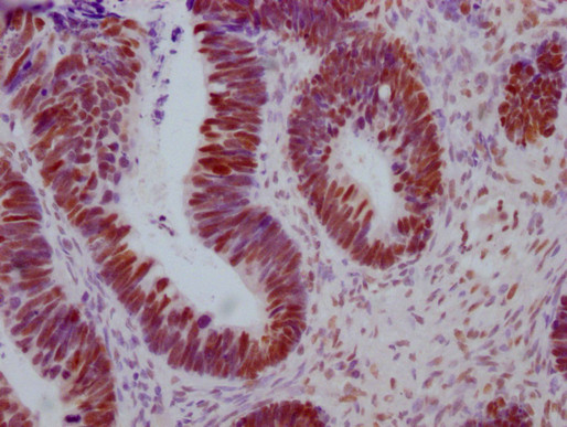 Anti-ESR1 Monoclonal