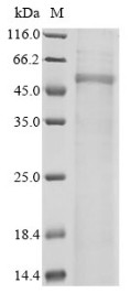 Wiskott-Aldrich syndrome protein (WAS), human, recombinant