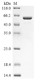 Lactase-like protein (LCTL), partial, human, recombinant