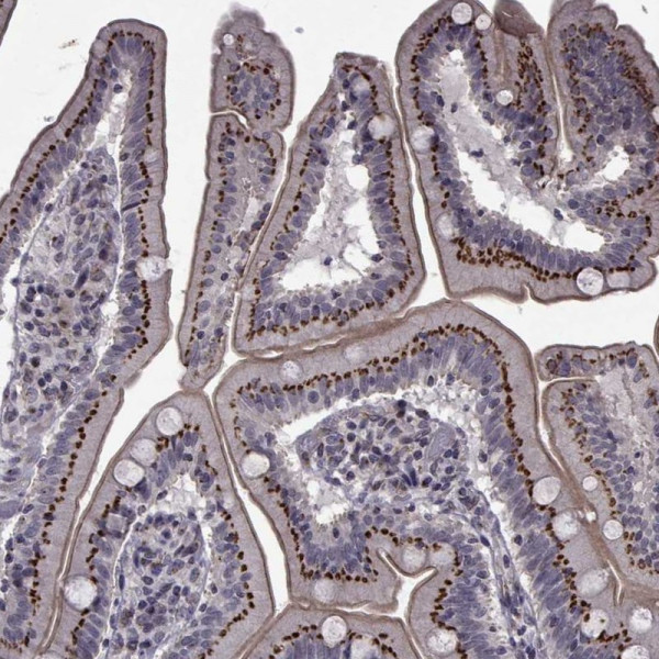 Anti-ATP6V1C2