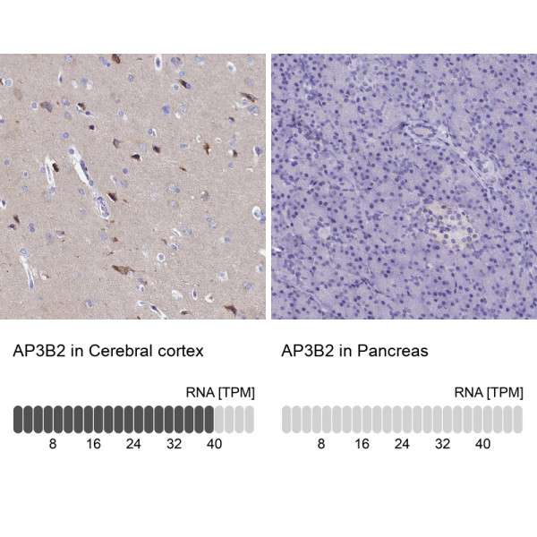 Anti-AP3B2