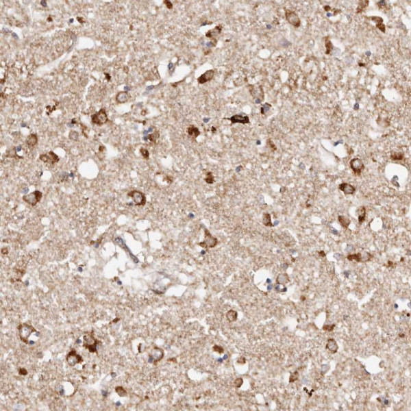 Anti-BCL2L15