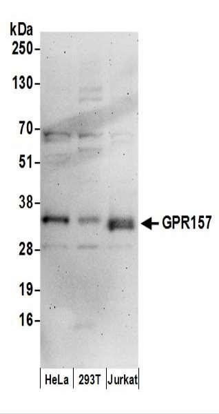Anti-GPR157